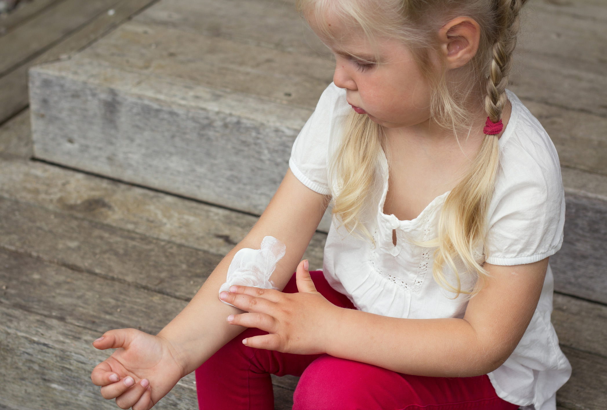 Eczema: the itch that doesn’t stop